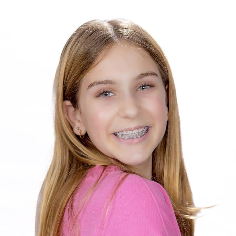 Patient Smiles LightForce Braces Orthodontic Treatment